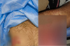 Bantwal: Mobile shop owner attacked with machete